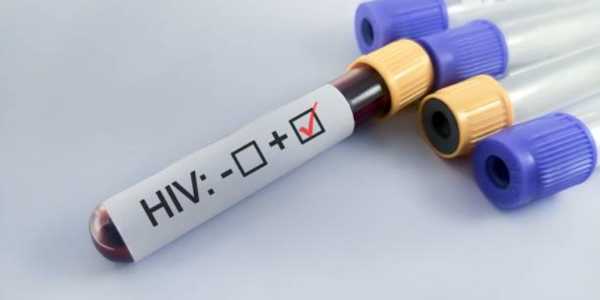 HIV Symptoms You Should Never Ignore: From Early Flu-like Signs to Long-term Effects